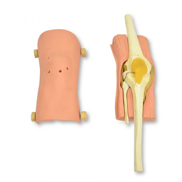 ARTROSCOPIA DE RODILLA